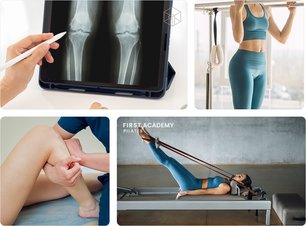 휜다리교정운동